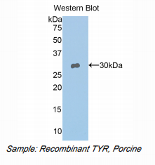 https://msimg.bioon.com/bionline/goods-no-pic.png