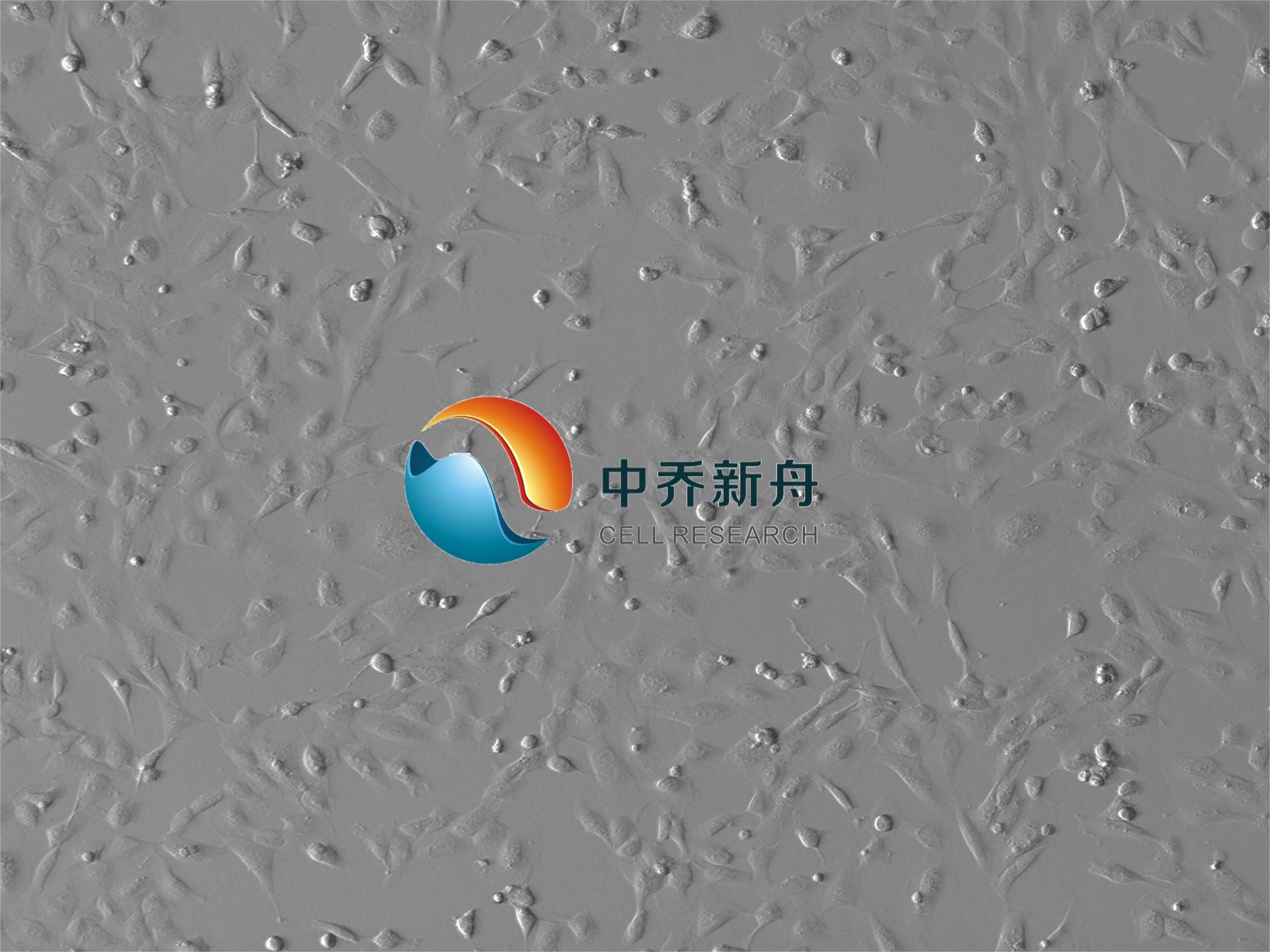 人卵巢癌成纤维细胞永生化