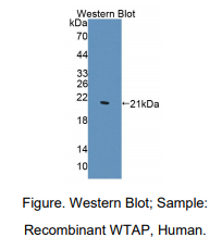 人肾母细胞瘤1关联蛋白(WTAP)多克隆抗体
