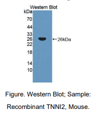 小鼠骨骼肌快肌肌钙蛋白I(TNNI2)多克隆抗体