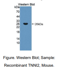 https://msimg.bioon.com/bionline/goods-no-pic.png