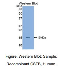 人半胱氨酸蛋白酶抑制剂B(CSTB)多克隆抗体