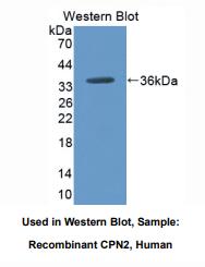 https://msimg.bioon.com/bionline/goods-no-pic.png