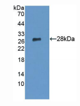 人溶血磷脂酶Ⅰ(LYPLA1)多克隆抗体