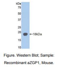 https://msimg.bioon.com/bionline/goods-no-pic.png