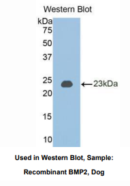 https://msimg.bioon.com/bionline/goods-no-pic.png