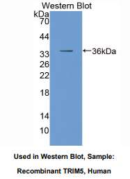 人含三联基元蛋白5(TRIM5)多克隆抗体