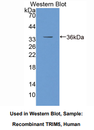 https://msimg.bioon.com/bionline/goods-no-pic.png