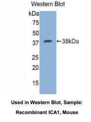 https://msimg.bioon.com/bionline/goods-no-pic.png