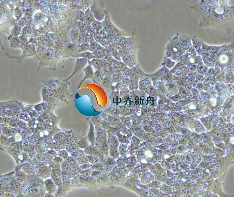 人非小细胞肺癌细胞