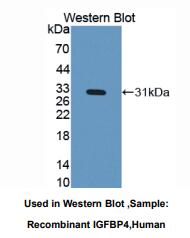 https://msimg.bioon.com/bionline/goods-no-pic.png