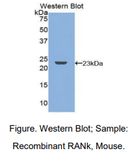 https://msimg.bioon.com/bionline/goods-no-pic.png