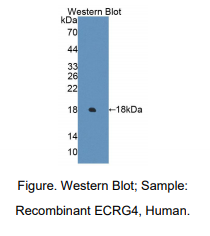 人食道癌相关基因4(ECRG4)多克隆抗体