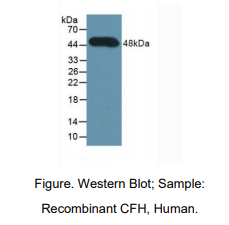 人补体因子H(CFH)多克隆抗体