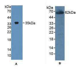 https://msimg.bioon.com/bionline/goods-no-pic.png