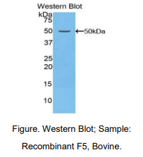 https://msimg.bioon.com/bionline/goods-no-pic.png