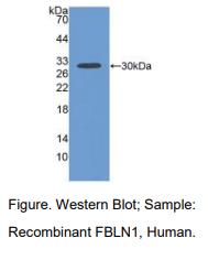 https://msimg.bioon.com/bionline/goods-no-pic.png