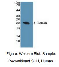 https://msimg.bioon.com/bionline/goods-no-pic.png