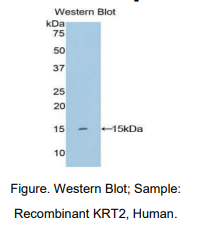 https://msimg.bioon.com/bionline/goods-no-pic.png