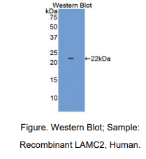 人层粘连蛋白γ2(LAMC2)多克隆抗体