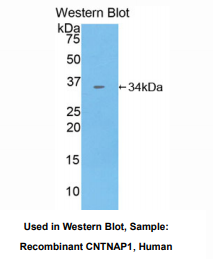 https://msimg.bioon.com/bionline/goods-no-pic.png