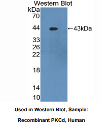 https://msimg.bioon.com/bionline/goods-no-pic.png