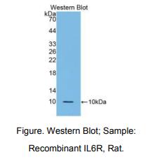 大鼠白介素6受体(IL6R)多克隆抗体