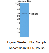 小鼠干扰素调节因子5(IRF5)多克隆抗体
