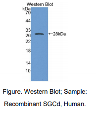 人肌糖δ(SGCd)多克隆抗体