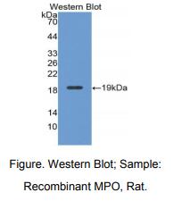 https://msimg.bioon.com/bionline/goods-no-pic.png