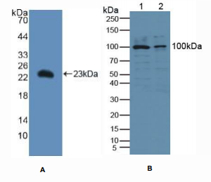 人胞浆型磷脂酶A2(PLA2G4)多克隆抗体