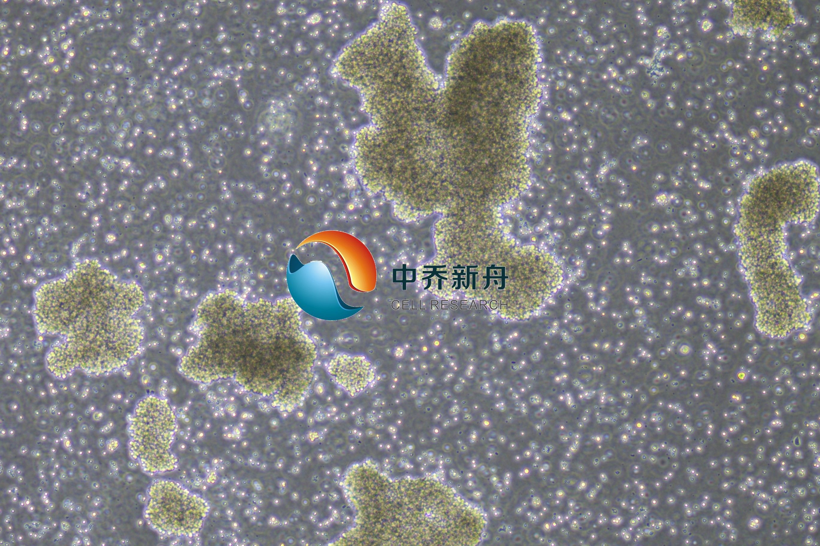 HuT102人T淋巴瘤细胞