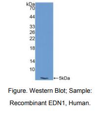 https://msimg.bioon.com/bionline/goods-no-pic.png