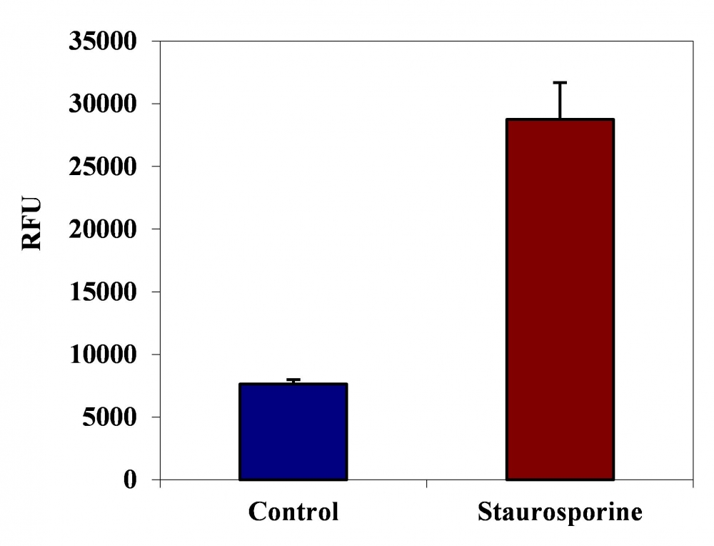 https://img.medsci.cn/e73eefcea40976357f460123cbf1e819c54e5106c9b457225be13b1cbc991aff.png