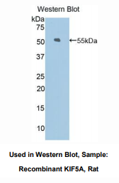 大鼠驱动蛋白家族成员5A(KIF5A)多克隆抗体