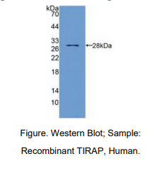 https://msimg.bioon.com/bionline/goods-no-pic.png