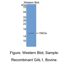 https://msimg.bioon.com/bionline/goods-no-pic.png