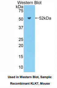 小鼠激肽释放酶7(KLK7)多克隆抗体