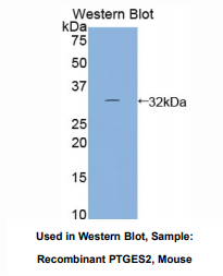 https://msimg.bioon.com/bionline/goods-no-pic.png