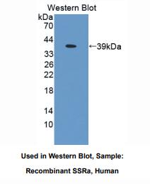 人信号序列受体α(SSRa)多克隆抗体