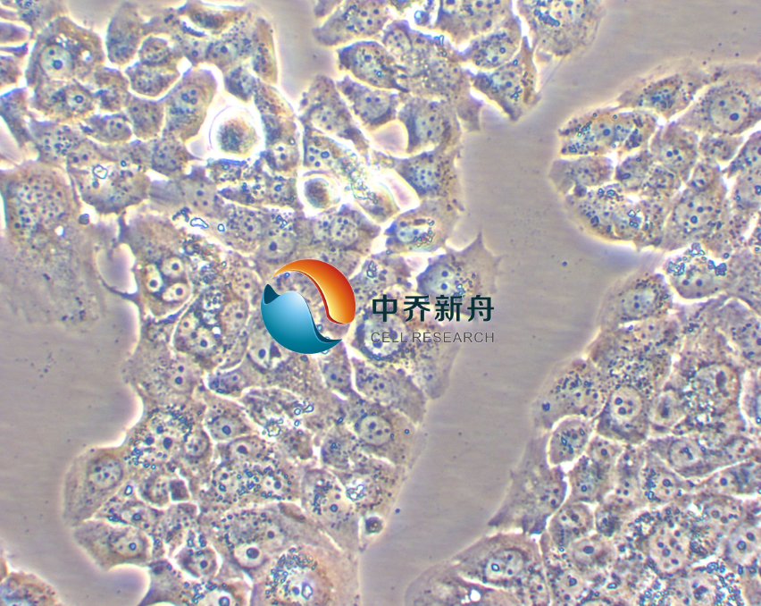 人乳腺腺癌细胞