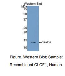 https://msimg.bioon.com/bionline/goods-no-pic.png