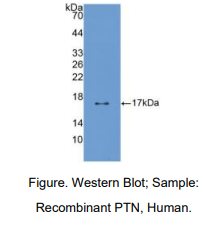 https://msimg.bioon.com/bionline/goods-no-pic.png