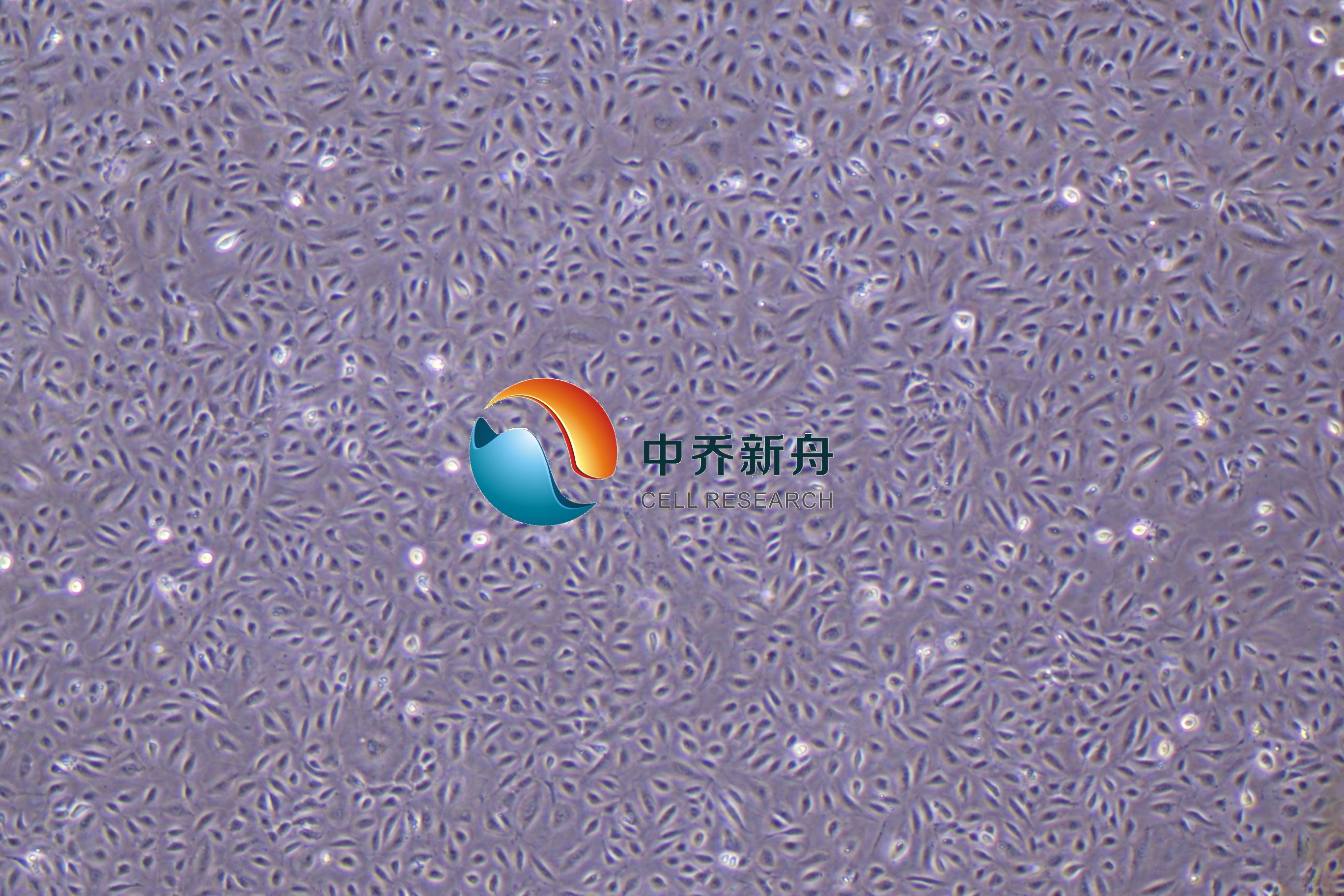 人肺微血管内皮细胞永生化