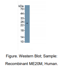 https://msimg.bioon.com/bionline/goods-no-pic.png