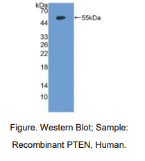 https://msimg.bioon.com/bionline/goods-no-pic.png