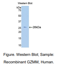 https://msimg.bioon.com/bionline/goods-no-pic.png