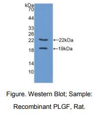 https://msimg.bioon.com/bionline/goods-no-pic.png