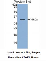 https://msimg.bioon.com/bionline/goods-no-pic.png