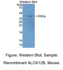 小鼠花生四烯酸-12-脂加氧酶12R(ALOX12B)多克隆抗体